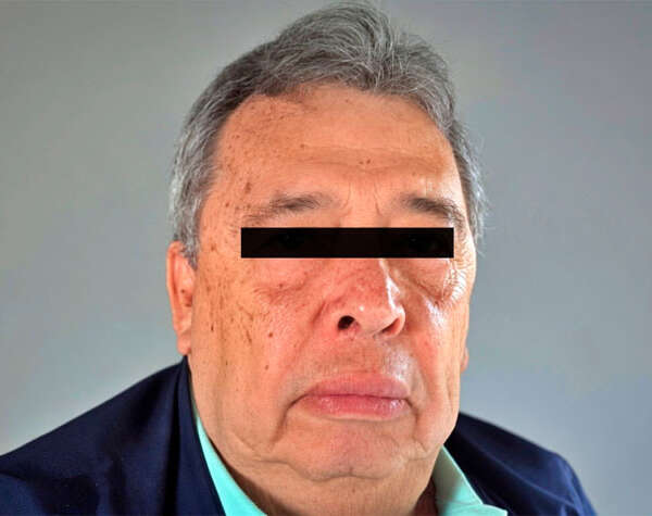 Detienen al exgobernador Ángel Aguirre en el caso de la desaparición de los 43 estudiantes de Ayotzinapa
